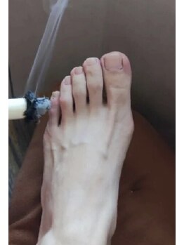 桜琴鍼灸治療院 赤坂店/年中無休