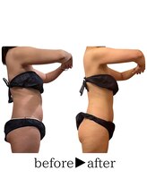 スタイルアップボディ ナゴミ(スタイルアップBODY！NAGOMI)/ボディのたるみ/セルケアに