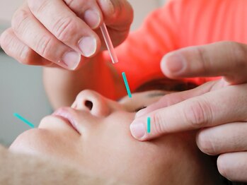 ツカダ治療院 つくばみどりの店(TSUKADA治療院)の写真/《つくばで美容鍼・鍼灸施術を》圧倒的な技術力でお肌・お身体の悩みを徹底改善◎初めての方にもおすすめ♪