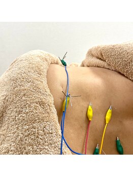 キャンディ鍼灸整骨院/施術風景