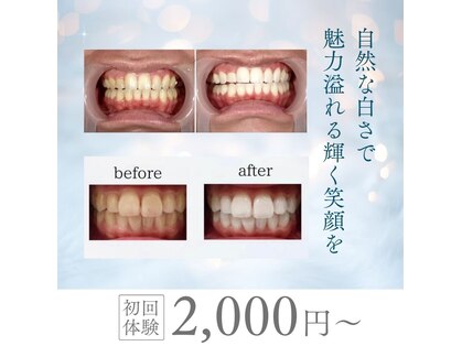 ルミナ(LUMINA)の写真