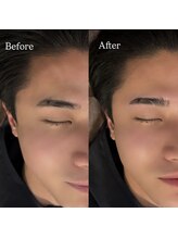 バレベッカ(Ballebecca)/HBL☆