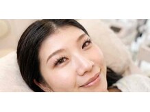 トゥルッカーレ(Turuccare)