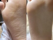 めぐみのネイルサロン/フット