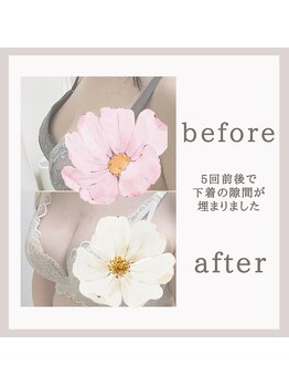 アリサナ(Arisana)/「下着の隙間が埋まりました」