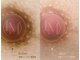 チェルビー(chelbe)の写真/【韓国で話題のルメラで色素沈着改善】人には相談しづらいバストトップのお悩みに寄り添うケア