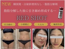 なごみの雰囲気(【1番人気】小顔効果◎『ヘアアップの横顔気になりませんか?』)