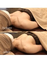 ユーティ(YOUTY)/一度目から効果実感☆