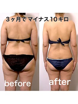 エステサロンクオーツ/全身痩身コース