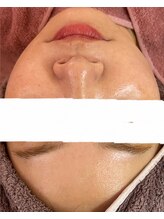 ソフィア(Sophia)/韓国VIPコース