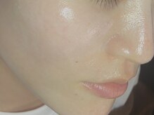 ブラックボックス(BLACK BOX)