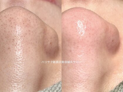 ハリサクの写真