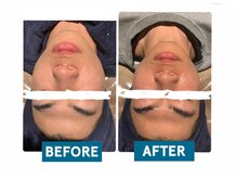 ビーアンドアイ シズオカテン メンズ(B＆I SHIZUOKA)の雰囲気（アーキテクト【造形美顔】コンパクト美顔/施術1回目）