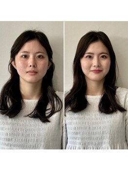 エイジレスビューティーアカデミー(Ageless Beauty Academy)/印象はここまで変わる