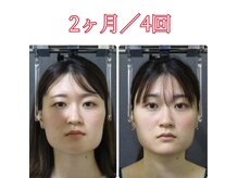 顔と身体の歪み矯正院 吉祥寺の雰囲気（ビフォーアフター）
