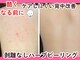 ビースキン 広島(BE:SKIN)の写真