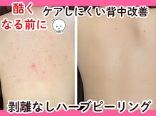 ビースキン 広島(BE:SKIN)