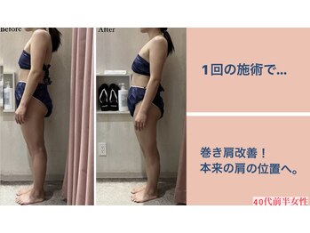 じぶんdeエステ 梅田店/CELLZERO.式 症例/肩/1回