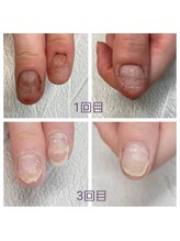 グレースレディ 神戸北店/