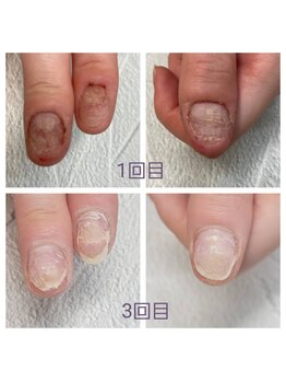 グレースレディ 神戸北店/