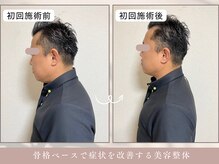 ほぐし屋 かすがい/初回/猫背巻き肩矯正