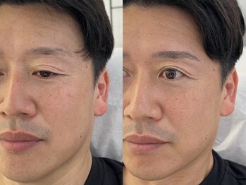 ワクシー 麻布十番店(WAXYYY.)/ハリウッドブロウリフト¥3,900～