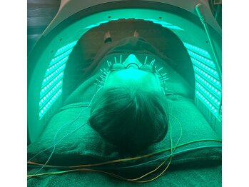 すぎ/シミケア＋リフトアップ美容鍼