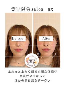 ミリグラム(mg)/フェイスラインが変わる！