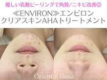 オリエンタルローザ 表参道(Oriental Rosa)/角質ニキビケア クリアスキンAHA
