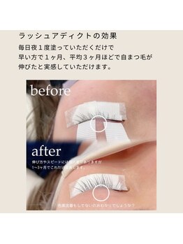 アイロ 田町三田店(I.RO)/ラッシュアディクト使用前・後