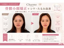 シャルム(Charme)｜ホットペッパービューティー