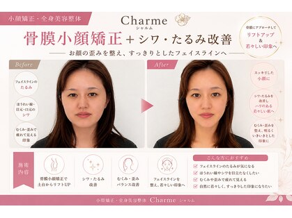シャルム(Charme)の写真