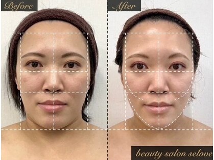 「小顔に本気。」都度払い小顔専門店beauty salon seloveの写真