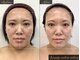 「小顔に本気。」都度払い小顔専門店beauty salon seloveの写真