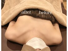 ユーティ(YOUTY)/左だけ施術でここまでの違い！