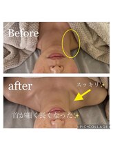 アイシー(I Sea)/夏に向けて首スッキリケア☆