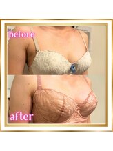 ジュエルリング(Jewel Ring)/バストアップ・育乳・恵比寿