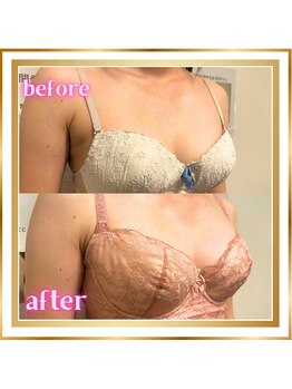 ジュエルリング(Jewel Ring)/バストアップ・育乳・恵比寿