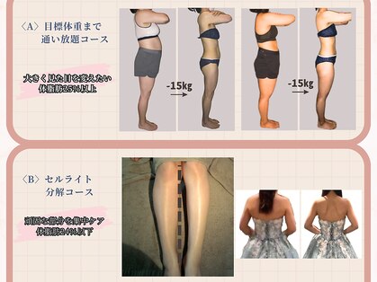 ビューティースリム リボーン 銀座店(reborn)の写真