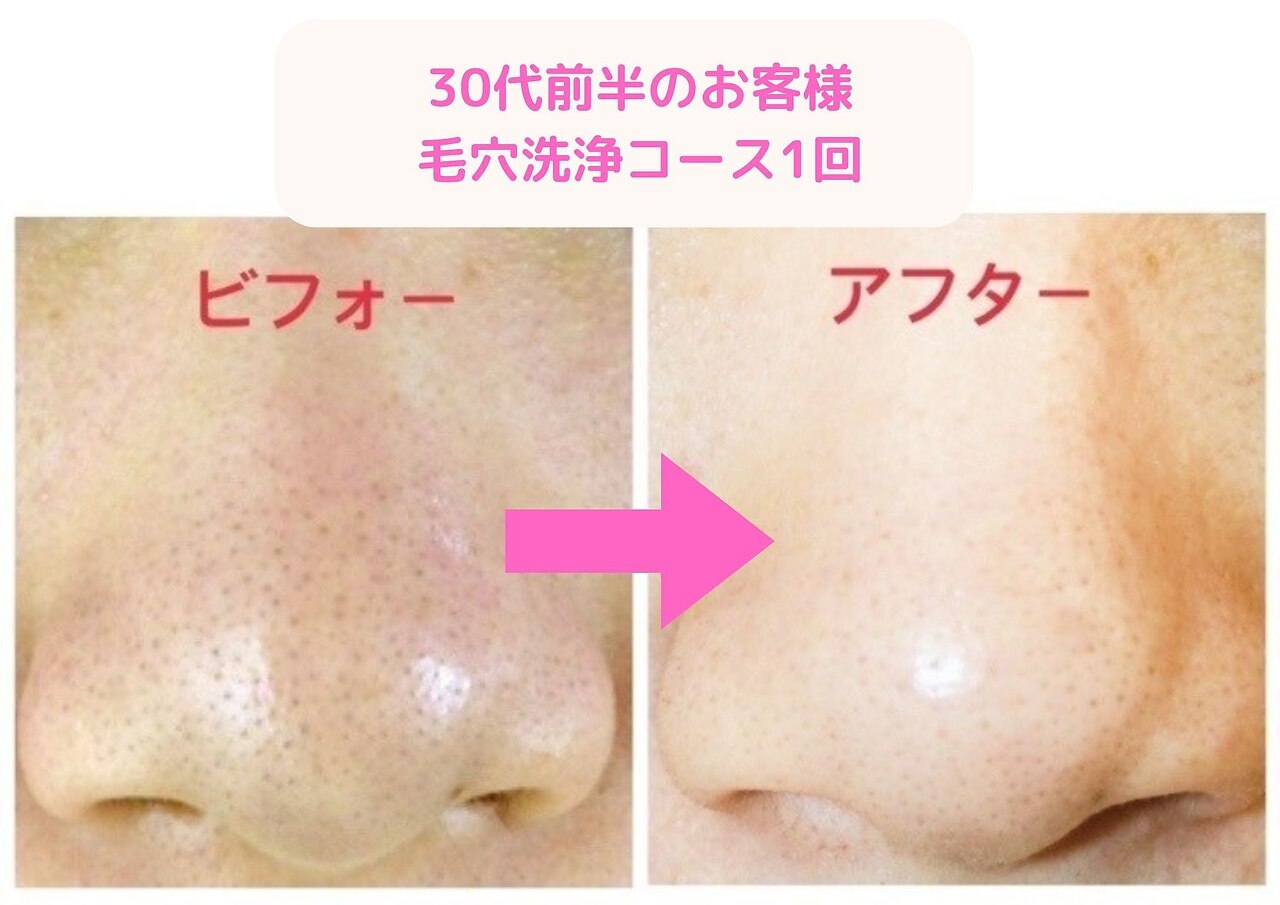 ヒーリング アンド ビューティー ナナ(Healing&Beauty nana