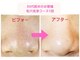 ヒーリング アンド ビューティー ナナ(Healing&Beauty nana)の写真