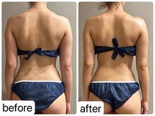 メロウ(me: llow)/ブライダルエステ/痩身エステ