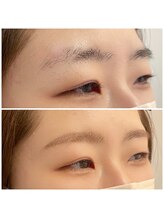 モアビューティ 光町店(MORE BEAUTY)/