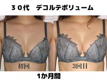 バストサロン メルベイユ(Merveile)/デコルテからふっくら、谷間UP