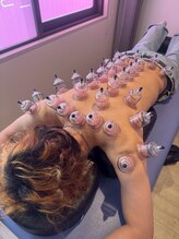 ビーワイ鍼灸整骨院 心斎橋院/冷えやだるさを根本改善