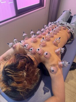 ビーワイ鍼灸整骨院 心斎橋院/冷えやだるさを根本改善