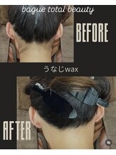 バーグトータルビューティー(bague total beauty)/うなじワックス＆光のダブル脱毛