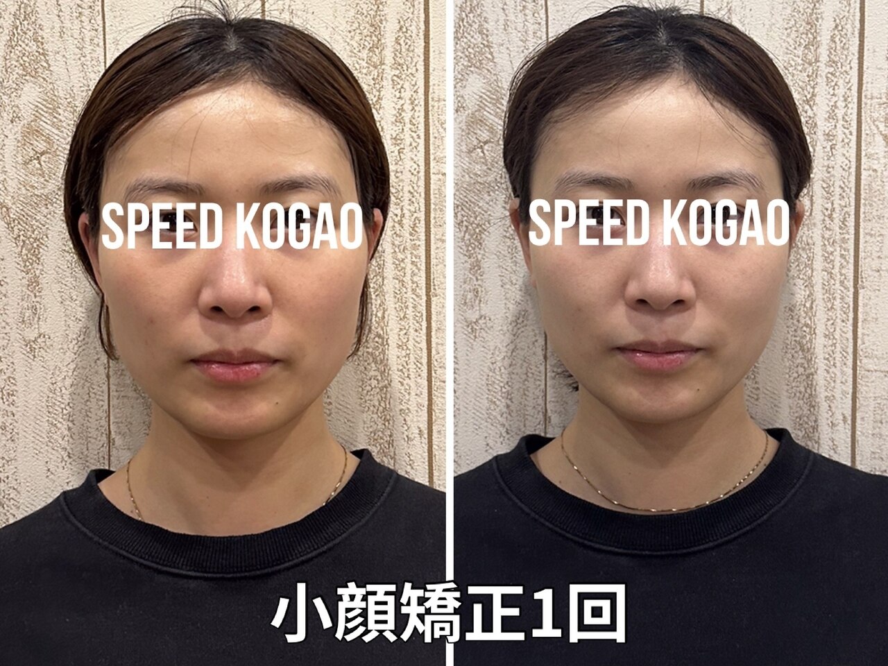 スピード小顔 渋谷店 (Speed)｜ホットペッパービューティー