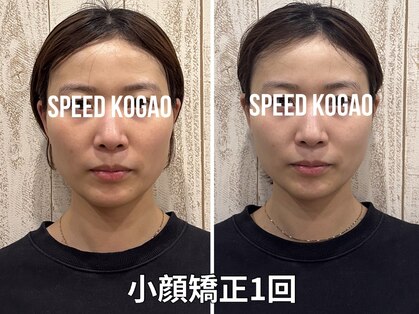スピード小顔 渋谷店 (Speed)の写真