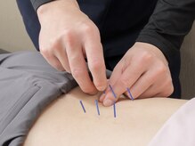 目黒不動前はりきゅう整骨院/全身鍼灸